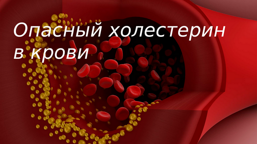 Холестерин из вены. Холестерин в крови. Что такое холестерин в крови человека. Холестерин норма у женщин. Норма холестерина в крови у женщин после 50.