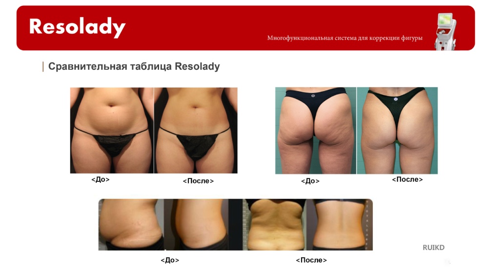 Особенности и преимущества Resolady