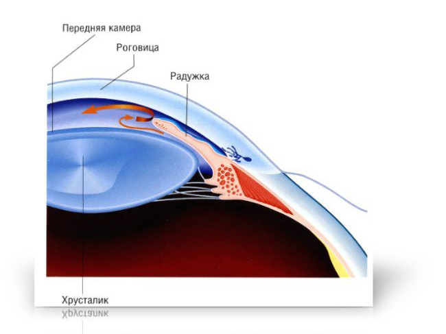 Формы глаукомы