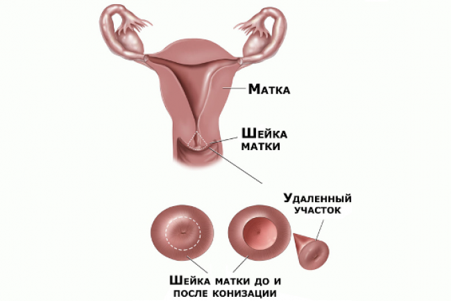 Можно ли вылечить заболевание?