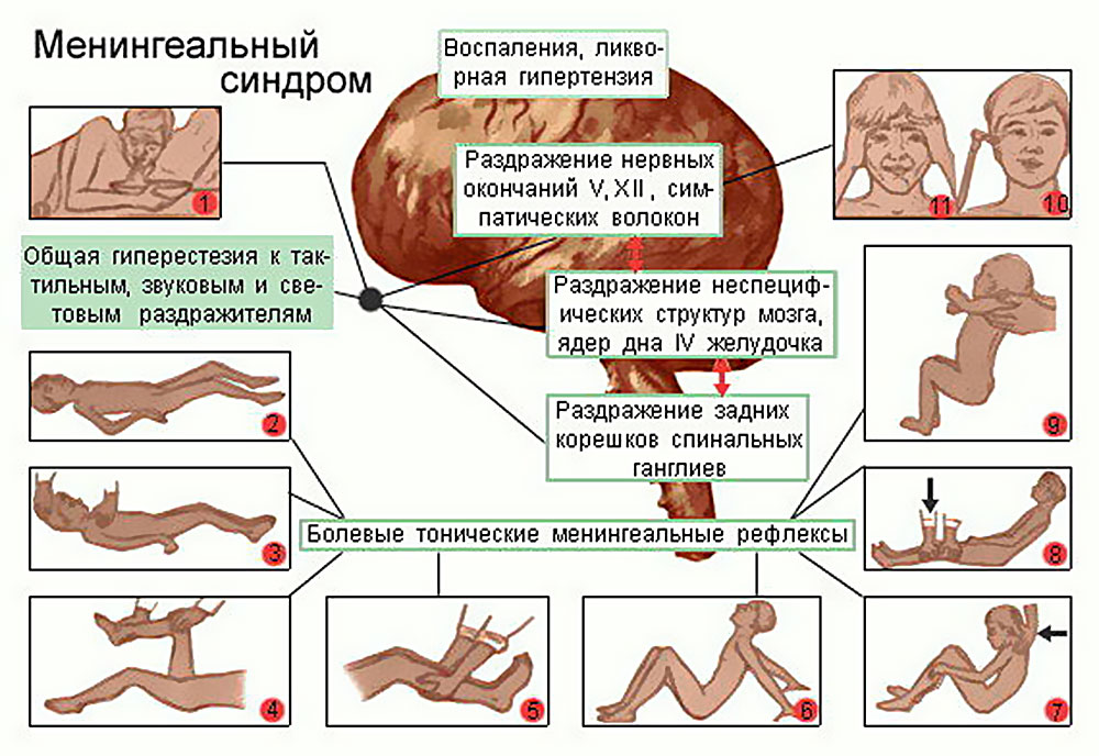 Черешня, абрикос и вода в кулерах - места обитания энтеровирусов - РИА Новости,