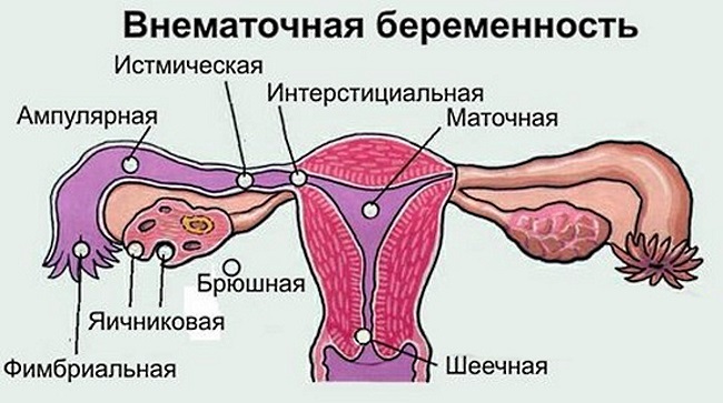 Определение понятия