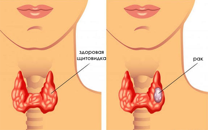 Причины возникновения