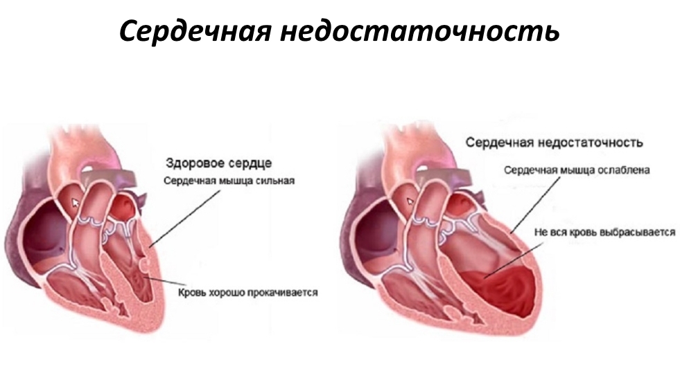 Причины возникновения патологии и возможные последствия