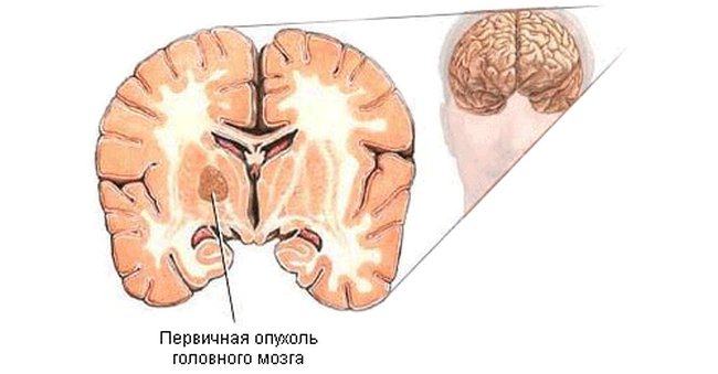 Классификация