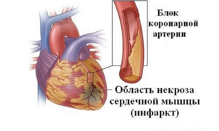 Когда требуется срочная помощь при болях под ребрами